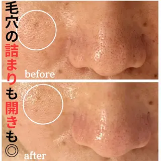 フェイシャル専門サロ ン ERINのエステ・リラクイメージ