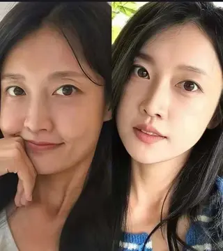 ネイル aliaハイフ&水光ジェットサロン所属・aliaハーブ水光店 エステティシャン募集のエステ・リラクイメージ