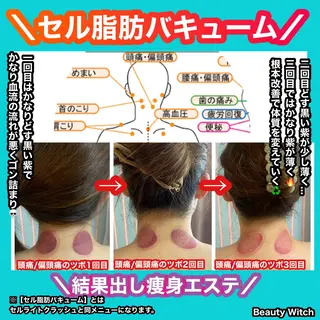 痩身/脱毛/ネイル HARUKAのエステ・リラクイメージ