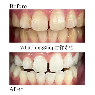 ホワイトニング ショップ吉祥寺店のエステ・リラクイメージ