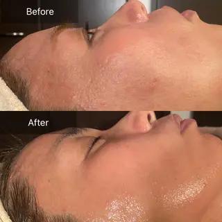 Mandarin Orange所属・毛穴から始める肌メン テマンダリンオレンジのエステ・リラクイメージ