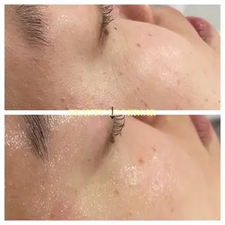 ビューティー ミロワールのエステ・リラクイメージ