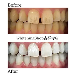 ホワイトニング ショップ吉祥寺店のエステ・リラクイメージ