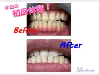 セルフホワイトニングサロン　ラヴィアン所属・ホワイトニングサロン La vie enのその他イメージ