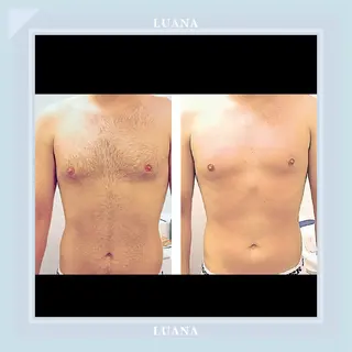 脱毛・小顔専門サロンLUANA所属・脱毛&シェービング 専門店　平岡のその他イメージ