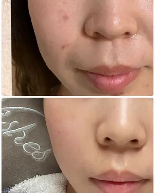 Sena Dewi所属・Sena Dewi 🫧Ayakaのエステ・リラクイメージ