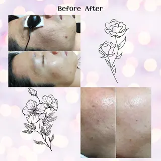 メンズ 男女同額完全個室脱毛 LEPIA内田のエステ・リラクイメージ