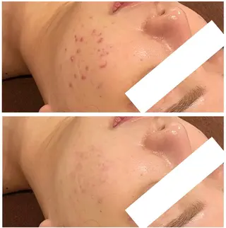 通うほど変わる本格 エステ心斎橋REVIのエステ・リラクイメージ