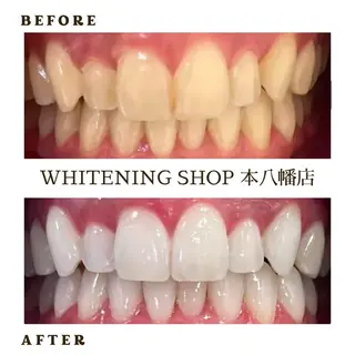 メンズ ホワイトニング ショップ本八幡店のエステ・リラクイメージ