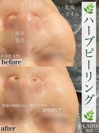 e-LABO こいずみのエステ・リラクイメージ