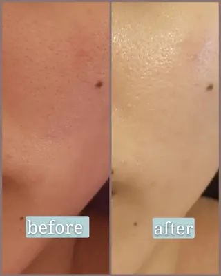 🅖🅤🅩🅔🅛 salonのエステ・リラクイメージ