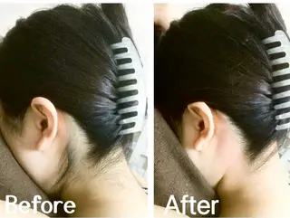 川越ローマピンク 光脱毛＆ワックス脱毛のエステ・リラクイメージ