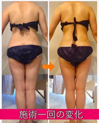 ロング カラー パーマ ヘアアレンジ メンズ キッズ ネイル マツエク・マツパ ‍痩身＆ボディ 結果出し🌟丹野のエステ・リラクイメージ