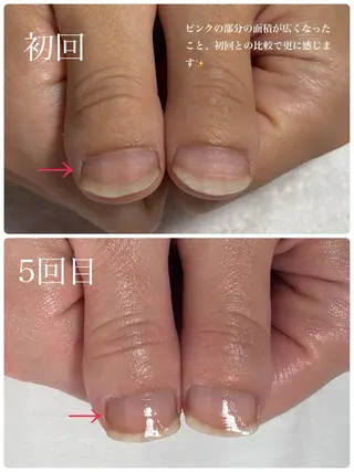 ネイル Alo.nail アロ•ネイルのネイルデザイン