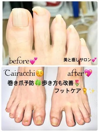 ネイル Tairacchi ﾀｲﾗｯﾁのエステ・リラクイメージ