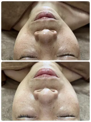 サロン・ド　シエル所属・サロン・ド シエルのエステ・リラクイメージ