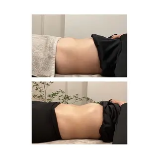 小顔サロンSharp …腸調整よもぎ蒸しのエステ・リラクイメージ