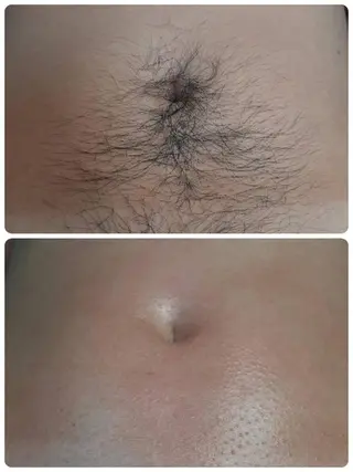 メンズ メンズ・脱毛サロン DEARS所属・山村幸久　メンズ脱毛 ディアーズのエステ・リラクイメージ