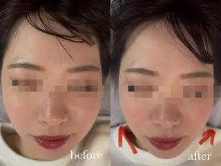 ENNE Lash&Blow by&ERA所属・ENNE🦩小顔整体 師🌿 HINAKOのエステ・リラクイメージ