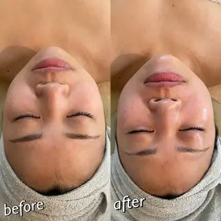 うなじ脱毛/美肌脱毛 LABELのエステ・リラクイメージ