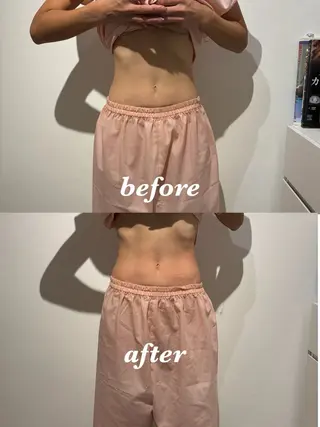 メンズ 腸活サポート みなみののエステ・リラクイメージ