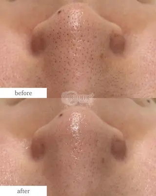 美の宝石屋さん gemme【ジェム】所属・gemme -ジェム-のエステ・リラクイメージ