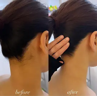 うなじ脱毛/美肌脱毛 LABELのエステ・リラクイメージ