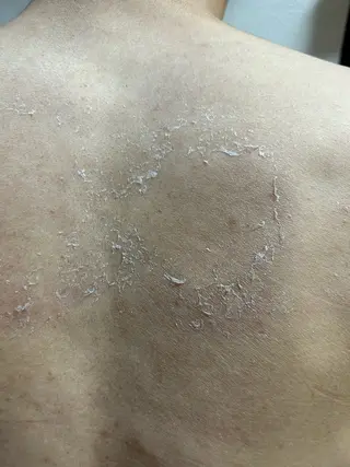 clé skin 🌿ハーブピーリングのエステ・リラクイメージ