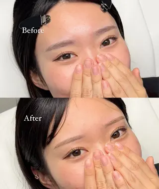 メンズ アイブロウ iBROW. 熊見怜奈の眉毛・アイブロウイメージ