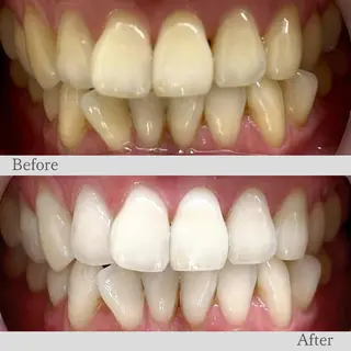 LBS吉祥寺 公式のエステ・リラクイメージ