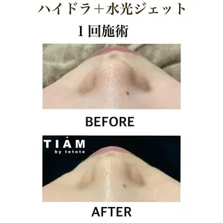 美肌サロンTIAM by tetoteのエステ・リラクイメージ