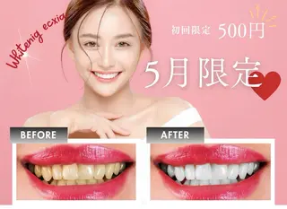 メンズ セルフホワイトニング エクシア徳島店マユのその他イメージ