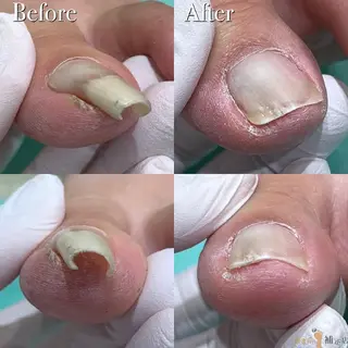 東京巻き爪アカデミー所属・東京巻き爪 アカデミーのエステ・リラクイメージ