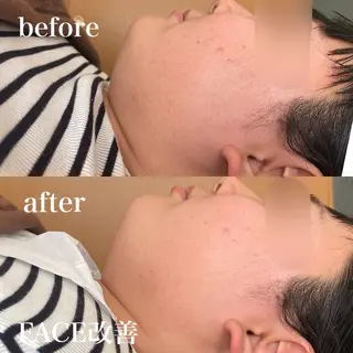 磐田｜LAYLA 一番丁寧な脱毛店のエステ・リラクイメージ