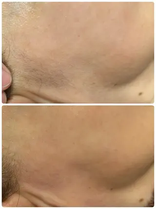 beauty  salon sorelle所属・艶肌/角質ケア フェイシャルワックスのエステ・リラクイメージ