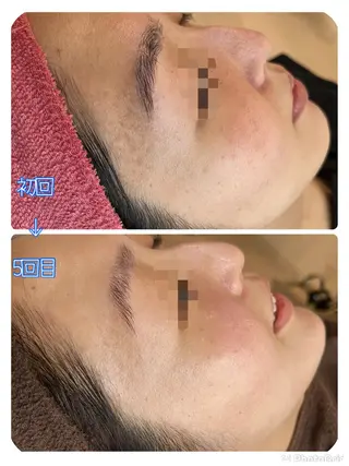 Dione八王子店所属・LUKE （ルーク）のエステ・リラクイメージ