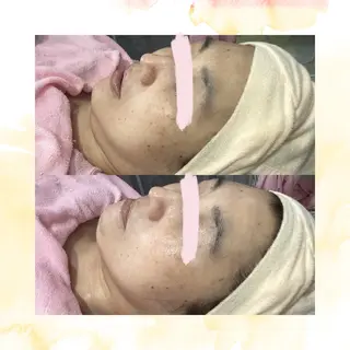 肌専門パーソナルエステサロンみゅうる所属・田村 由佳のその他イメージ