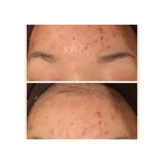 ミディアム カラー パーマ ヘアアレンジ メンズ キッズ ネイル マツエク・マツパ 四つ星サロン🎖 腸＆ニキビケアに特化のエステ・リラクイメージ