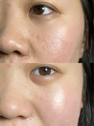 エステサロン lindyのエステ・リラクイメージ