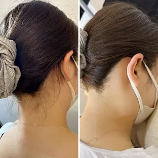 うなじ脱毛/美肌脱毛 LABELのエステ・リラクイメージ