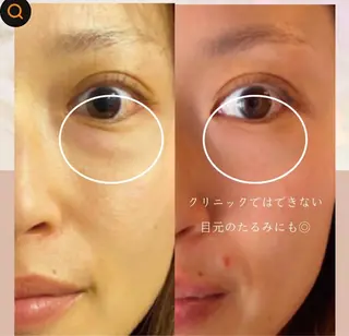 美肌・小顔専門🪄 看護師施術/松﨑のエステ・リラクイメージ