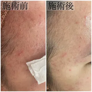 毛穴ケア専門店 Cynthiaのエステ・リラクイメージ