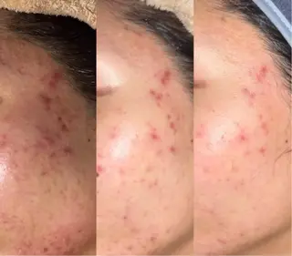 🦋肌改善 laule'a🦋のエステ・リラクイメージ