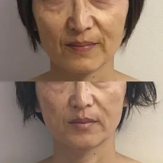 氣楽所属・松下 さゆりのエステ・リラクイメージ