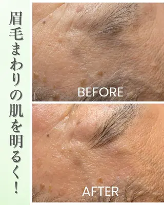 フェイシャルワックス GLOW所属・渡邊 真依のエステ・リラクイメージ