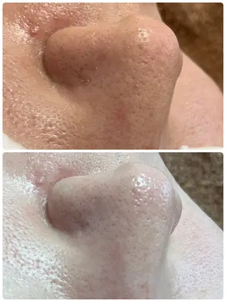 beautysalon LINO所属・平日昼間限定★ 全メニュ¥6600のエステ・リラクイメージ