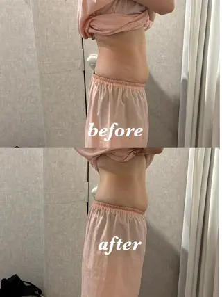 メンズ 腸活サポート みなみののエステ・リラクイメージ