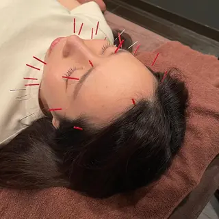 小林整骨院玉川 キジマのエステ・リラクイメージ