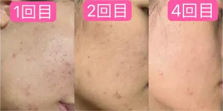 Nature Souce毛穴専門店のその他イメージ