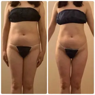 Re:Oasis所属・🦋Re:Oasis 近藤美貴【四谷】🦋のエステ・リラクイメージ